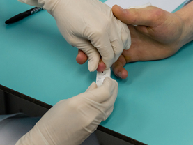 В Рязани в обязательную диспансеризацию включили HbA1c: шанс поймать диабет до его вспышки